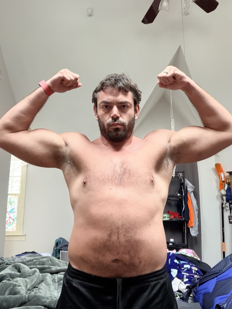 I Was 238 lbs With a Broken Ankle: The Post-Cruise Reality Check